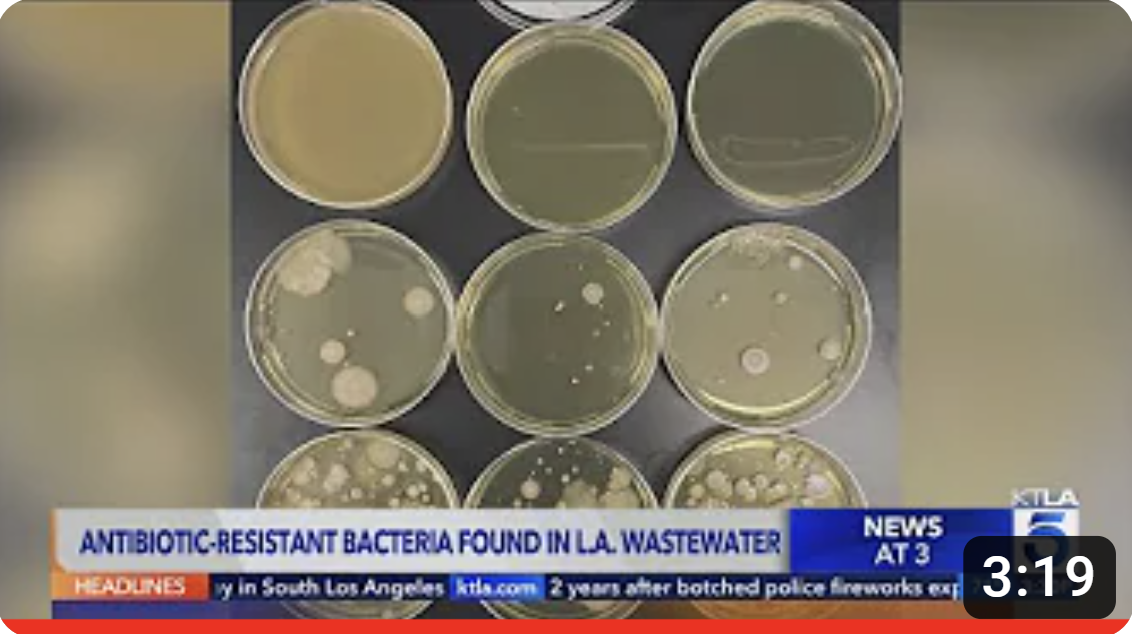 Antibiotic-resistant super bacteria found for the first time in Los Angeles County